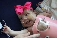 国内做三代试管助孕的流程并不复杂，解析安徽省立医院三代试管流程步骤